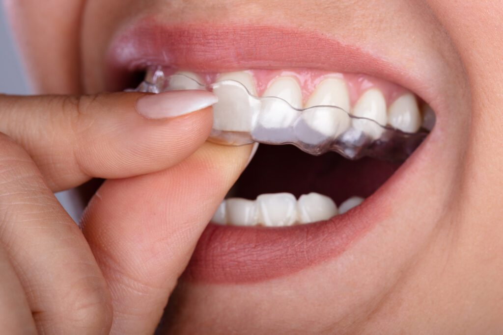 General and Cosmetic Dentistry in Port Richey General and Cosmetic Dentistry in Port Richey