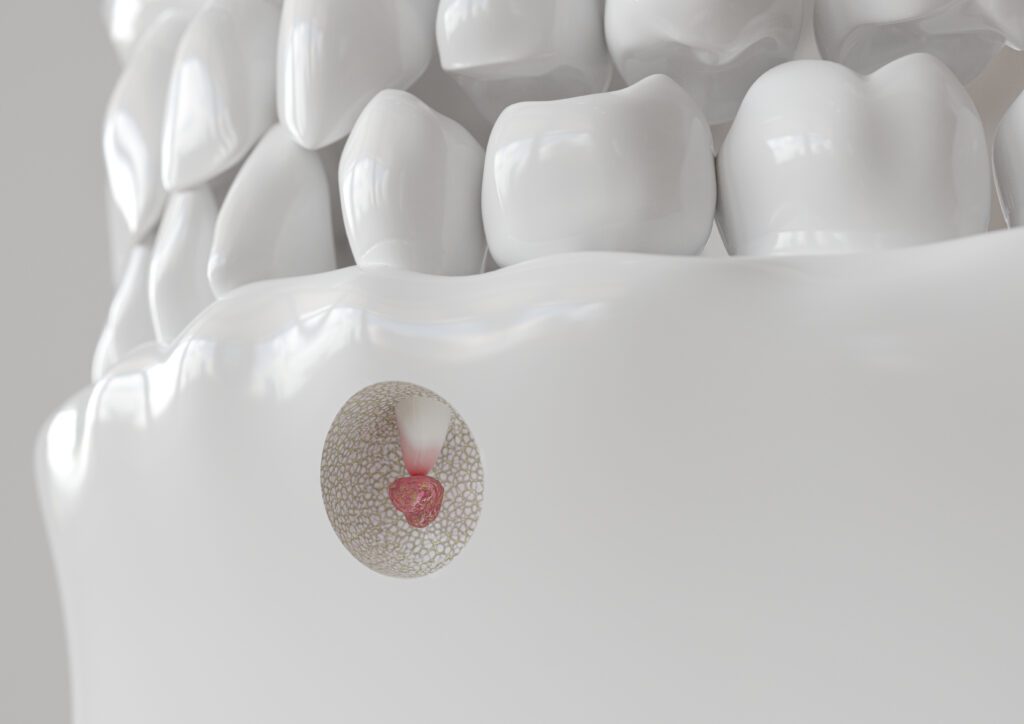 General and Cosmetic Dentistry in Port Richey