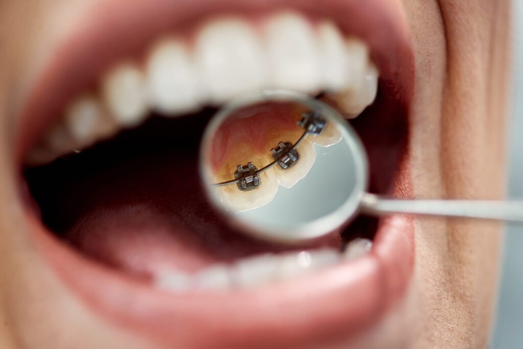 General and Cosmetic Dentistry in Port Richey General and Cosmetic Dentistry in Port Richey