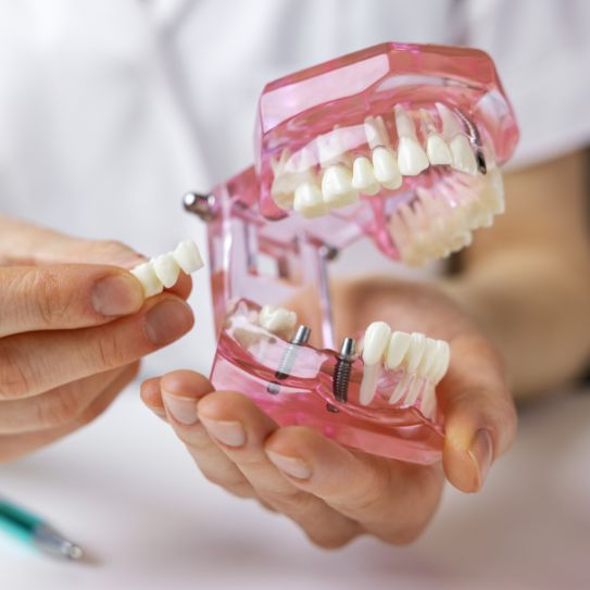 General and Cosmetic Dentistry in Port Richey Dental implants