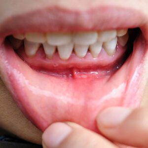 General and Cosmetic Dentistry in Port Richey General and Cosmetic Dentistry in Port Richey